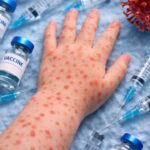 Корь в Казахстане: рост заболеваемости и усиление вакцинации